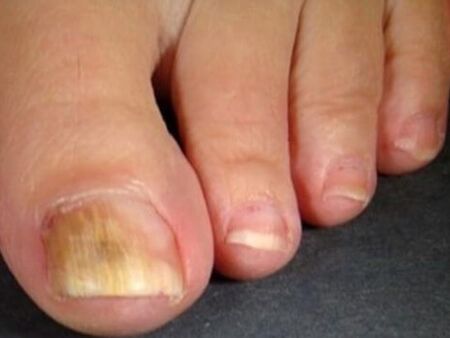 Nail