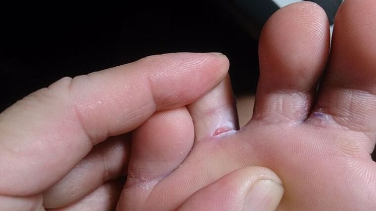 Foot