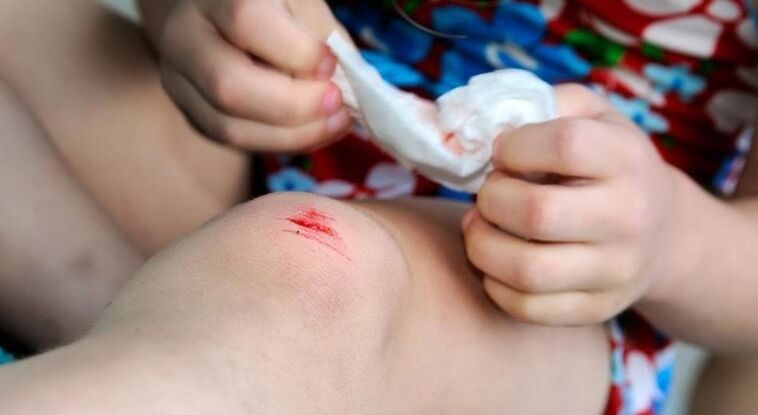 How can you get a fungus infection